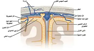 أم عنكبوتية