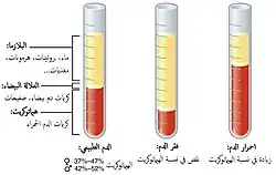 مكونات الدم والامراض.