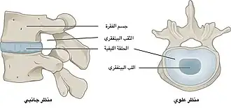 قرص فقري
