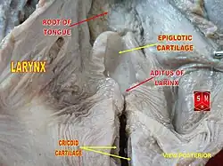 مدخل الحنجرة مؤشر عليه بالسهم الأحمر: Aditus of larynx.