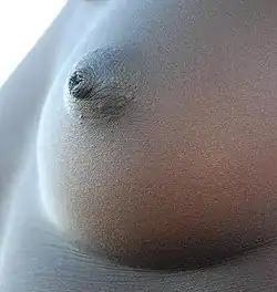 مثال على شق الحلمة