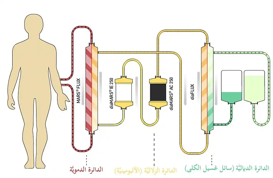 الزلال غسيل الكلى الدائرة