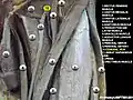 وريد فخذي