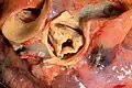 تشريح الجثة specimen showing the coronary ostia and proximal segments of the coronary arteries. Compare with غرايز أناتومي (كتاب) drawing above.
