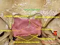 قاعدة الجمجمة - السرج التركي