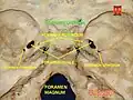 الثقبة الممزقة