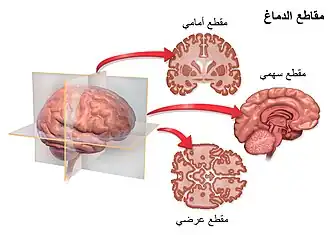 مستوى مقعطي للدماغ.