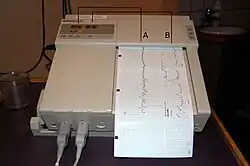 Cardiotocography diagram