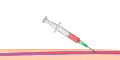 الخطوة 1