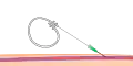 الخطوة 2