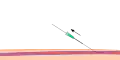 الخطوة 3