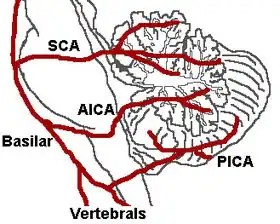 The three major arteries of the cerebellum: the SCA, AICA, and PICA. (Vertebrals labeled at bottom.)
