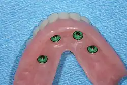 طقم به اربع أماكن لغطء الغرسات