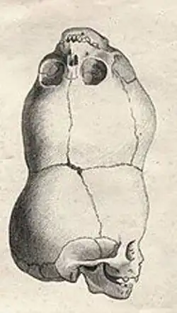 رسم جمجمة طفل ولد عام 1783 في البنغال ضمن حالة متحد القحفين الطفيلي