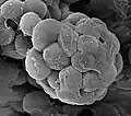 Creolimax fragrantissima, an ichthyosporean that infects peanut worms
