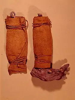 مِسماة صبي المستنقع Søgårds Mose Man ، الدَّنِمرك، العصر الحديدي المبكر