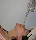 الشفط البلعوم الأنفي