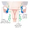 المرحلة الثالثة للورم