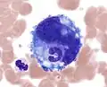اختراق الخلية: مجموعة الخلايا المتعادلة داخل الخلايا المنتجة للصفائح الدموية.(رايت وجيمسا(Wright-Giemsa)،100x, oil).