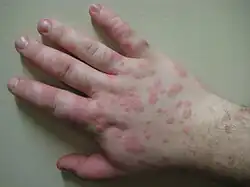 حمامى عديدة الأشكال