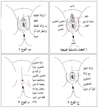 رسم بياني