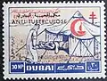 30 بيزة