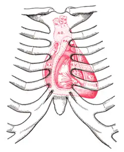 Diagram showing relations of opened قلب to front of جدار الصدر.Ant. Anterior segment of صمام ثلاثي الشرفات.A O. أبهر.A.P. Anterior عضلة حليمية.In. شريان عضدي رأسي.L.C.C. Left شريان سباتي أصلي.L.S. Left شريان تحت الترقوة.L.V. بطين أيسر.P.A. جذع رئوي.R.A. أذين أيمن.R.V. بطين أيمن.V.S. حاجز بين البطينين.
