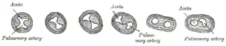 Transverse sections through the الكيس الأبهري&nbsp;&nbsp;[لغات أخرى]‏ to show the growth of the aortic septum. The lowest section is on the left, the highest on the right of the figure.