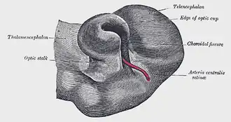 Optic cup and choroidal fissure seen from below, from a human embryo of about four weeks. (Edge of optic cup labeled at upper right.)