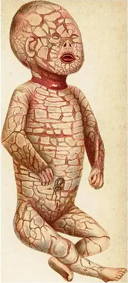 الوليد المهرج