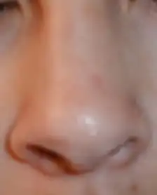 أنف طفل