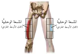 موقع الحقن في المتسعة الوحشية عند البالغين
