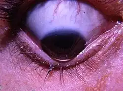 علامة مونسون