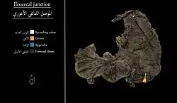 الموصل اللفائفي الأعوري (يظهر اللفائفي الانتهائي باللون البني)