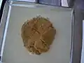 إزالة الورم الشحمي من الثدي