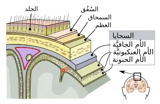 سحاءة الجهاز العصبي المركزي