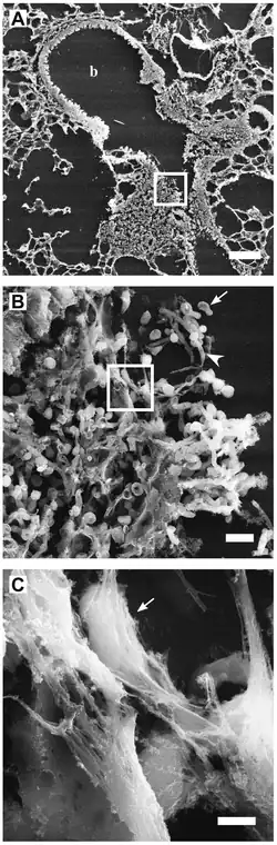 Neutrophil Extracellular Traps
