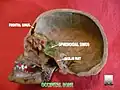 العظم القذالي