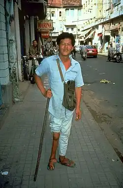 رجل ذو ساق أيمن أصغر بسبب إصابته بشلل الأطفال.