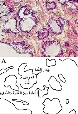 البروستات تحت المجهر الصوة توضح الغدد المجهرية في البروستات