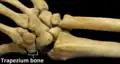 مفصل سرجي.