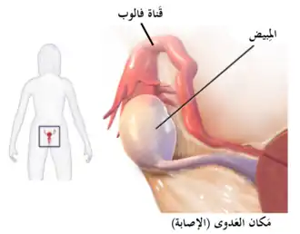 خراج بوقي مبيضي