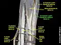 Extensor carpi radialis longus muscle