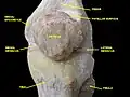 مفصل الركبة. تشريح عميق. عرض أمامي-إنسي.الرضفة (Patella) وسط الصورة.