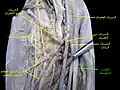 العصب المتوسط