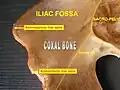 الحفرة الحرقفية