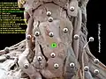 الرباط الحلقي الدرقي.