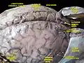 السحايا والأوردة الدماغية السطحية. تشريح عميق.