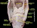 عضلة طرجهالية (بالإنجليزية: Aryepiglotic muscle).