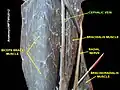 الوريد الرأسي